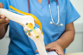 Best Knee Replacement Surgeon