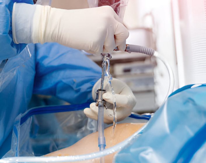 PCL Injurytreatments
