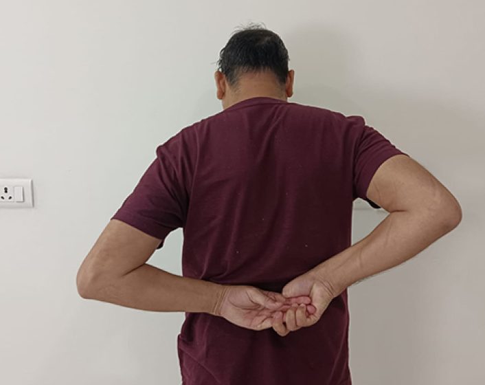 Reverse shoulder replacement3